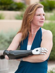 Coapt user crossing her arms