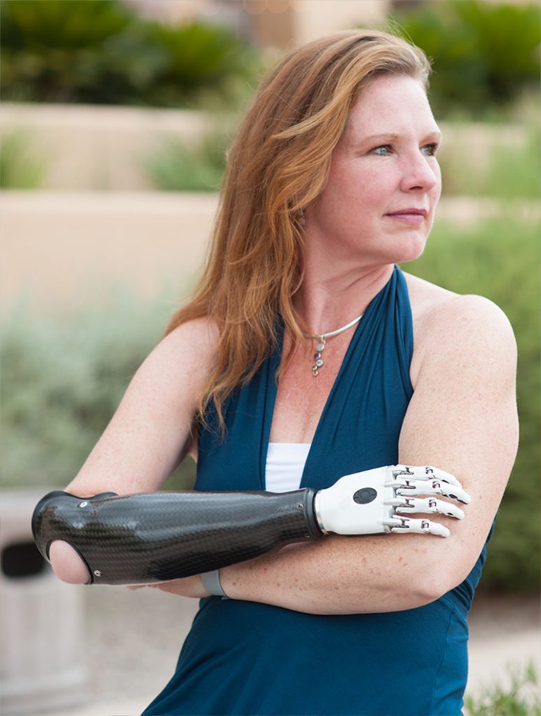 Coapt user crossing her arms