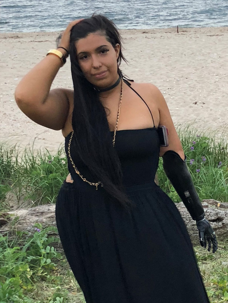 Coapt user Dayna posing on the beach.