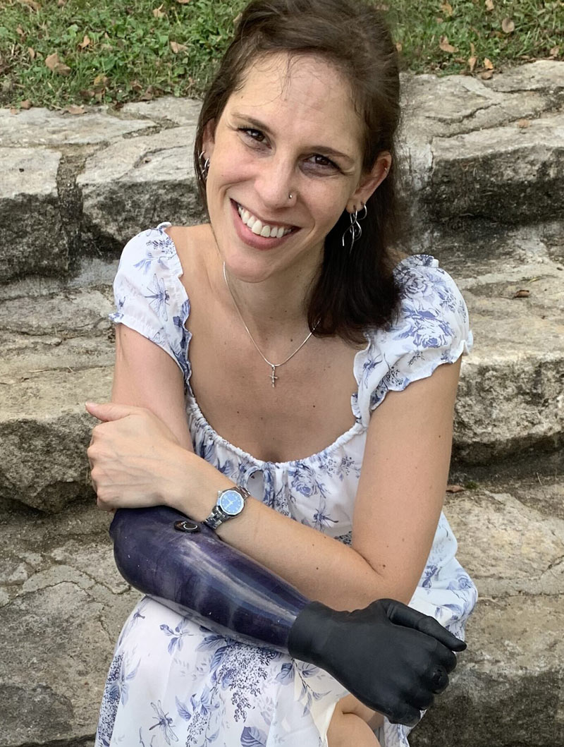 Coapt user Kaylin sitting on the stairs and smiling.