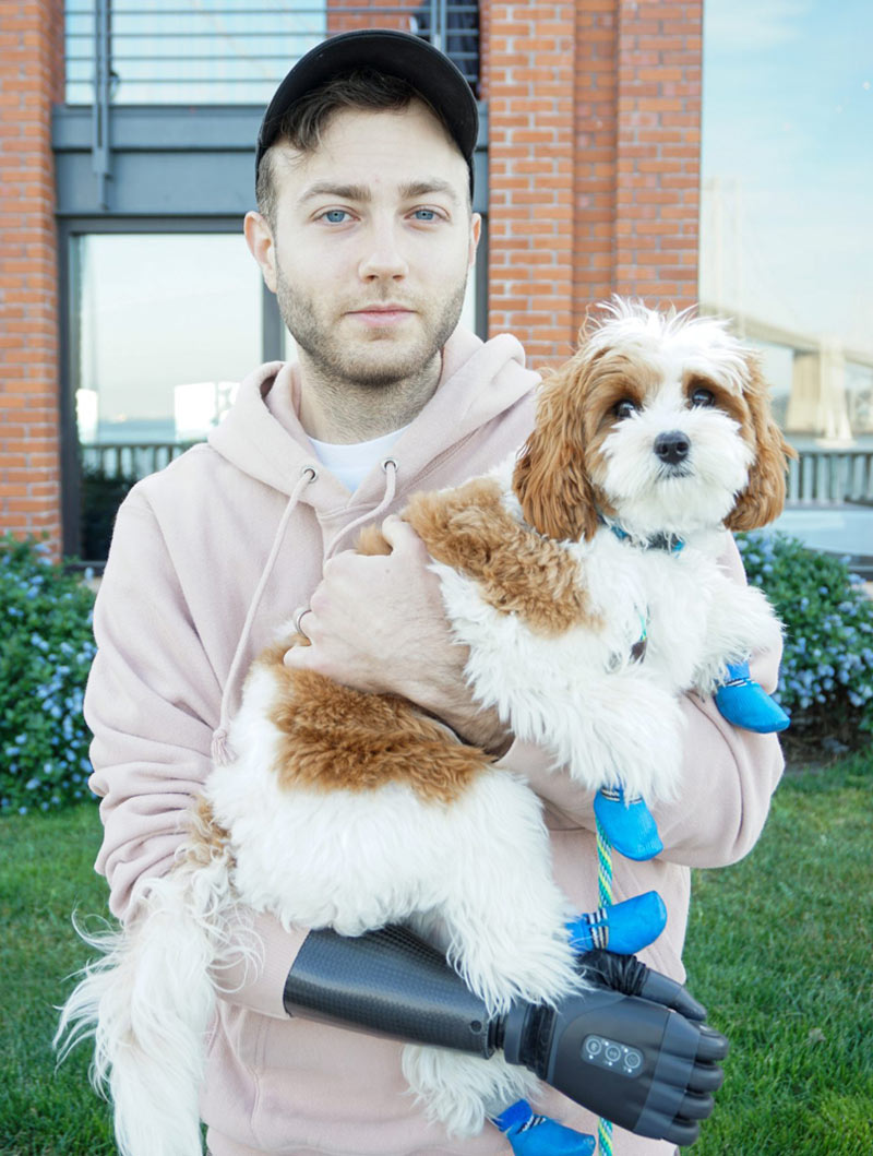 Coapt user Nic holding his dog with his prosthesis.